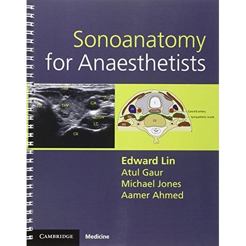 Sonoanatomy for Anaesthetists (Cambridge Medicine (Paperback))