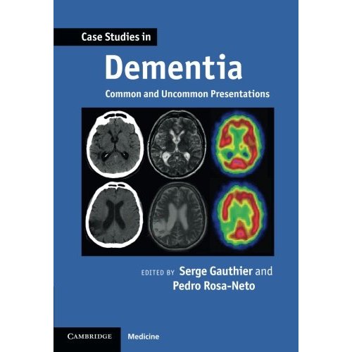 Case Studies in Dementia: Common And Uncommon Presentations (Case Studies in Neurology)