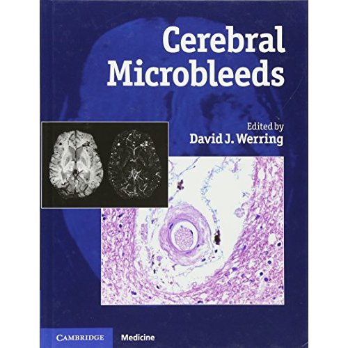 Cerebral Microbleeds: Pathophysiology to Clinical Practice (Cambridge Medicine)