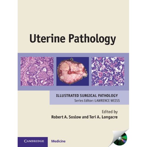 Uterine Pathology (Cambridge Illustrated Surgical Pathology)