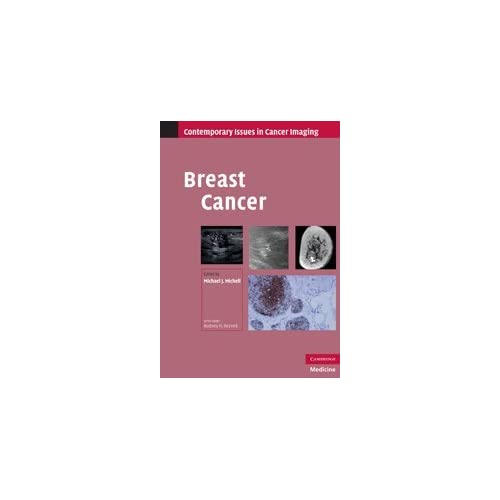 Breast Cancer (Contemporary Issues in Cancer Imaging)