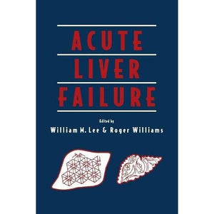 Acute Liver Failure