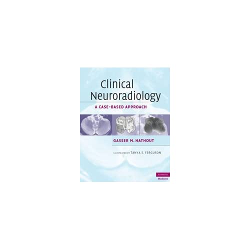 Clinical Neuroradiology: A Case-Based Approach (Cambridge Medicine (Hardcover))