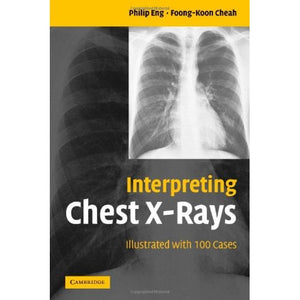 Interpreting Chest X-Rays: Illustrated with 100 Cases