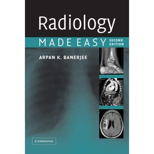 Radiology Made Easy, Second Edition