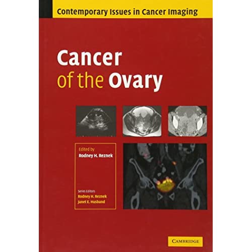 Cancer of the Ovary: 1 (Contemporary Issues in Cancer Imaging)