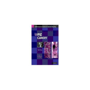 Lung Cancer (Contemporary Issues in Cancer Imaging)