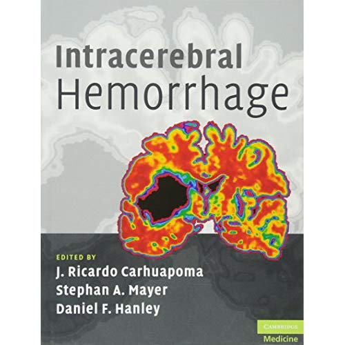Intracerebral Hemorrhage