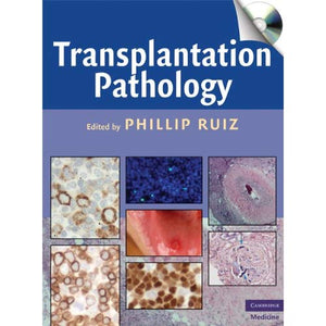 Transplantation Pathology