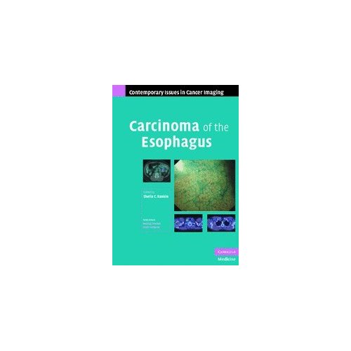 Carcinoma of the Esophagus (Contemporary Issues in Cancer Imaging)