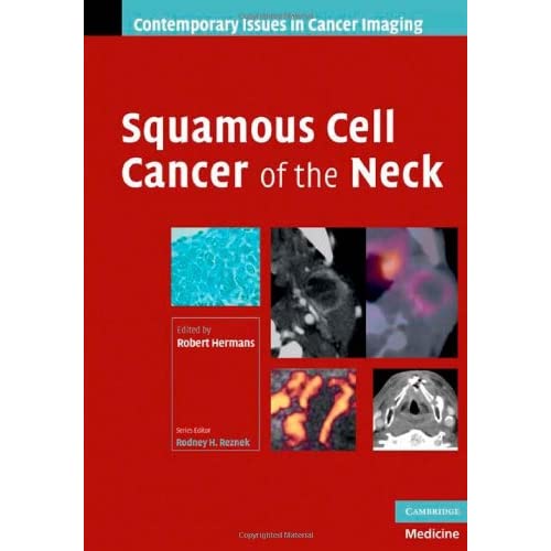 Squamous Cell Cancer of the Neck (Contemporary Issues in Cancer Imaging)