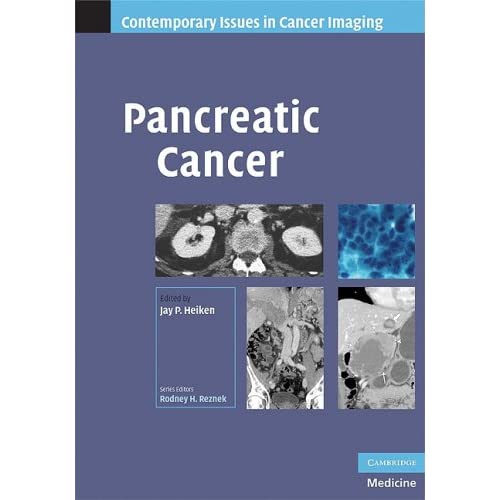 Pancreatic Cancer (Contemporary Issues in Cancer Imaging)