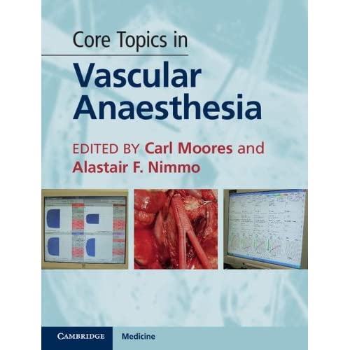 Core Topics in Vascular Anaesthesia