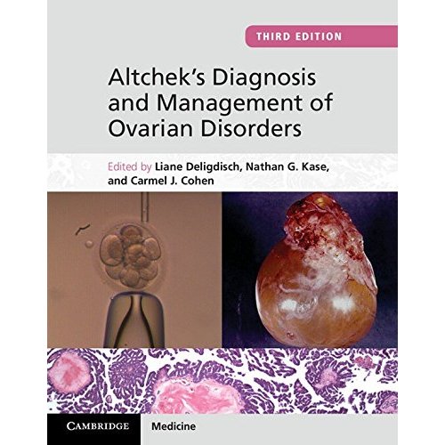 Altchek's Diagnosis and Management of Ovarian Disorders
