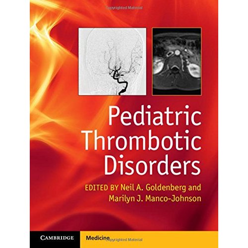 Pediatric Thrombotic Disorders