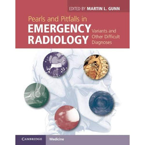 Pearls and Pitfalls in Emergency Radiology: Variants and Other Difficult Diagnoses