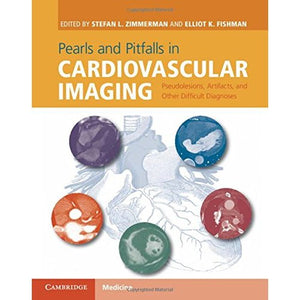 Pearls and Pitfalls in Cardiovascular Imaging: Pseudolesions, Artifacts, and Other Difficult Diagnoses