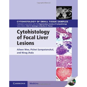 Cytohistology of Focal Liver Lesions (Cytohistology of Small Tissue Samples)