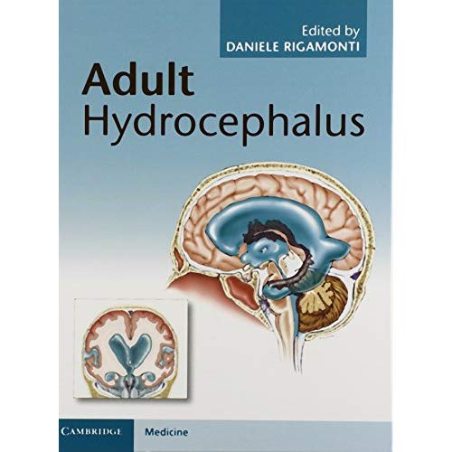 Adult Hydrocephalus