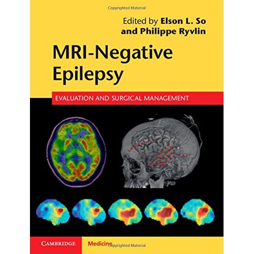 MRI-Negative Epilepsy: Evaluation and Surgical Management
