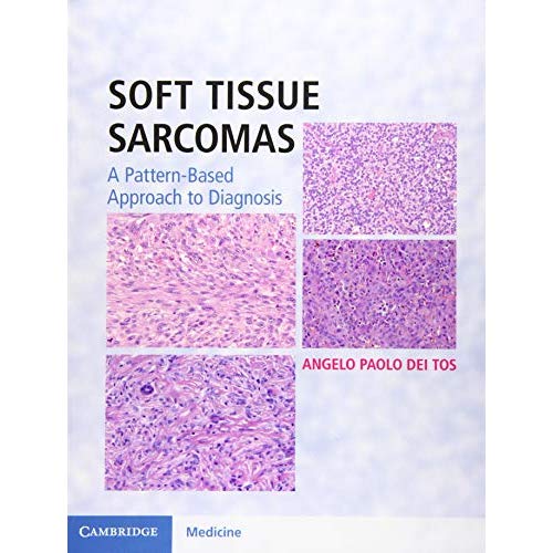 Soft Tissue Sarcomas Hardback with Online Resource: A Pattern-Based Approach to Diagnosis