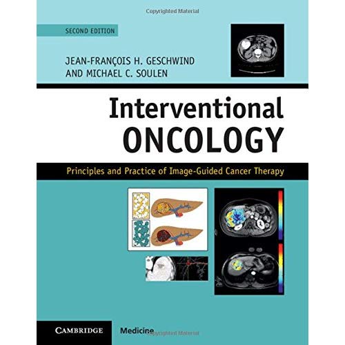 Interventional Oncology