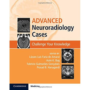 Advanced Neuroradiology Cases: Challenge Your Knowledge