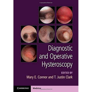 Diagnostic and Operative Hysteroscopy