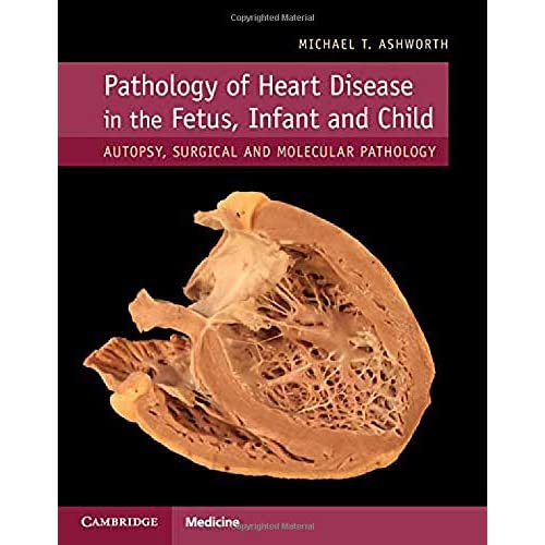 Pathology of Heart Disease in the Fetus, Infant and Child: Autopsy, Surgical and Molecular Pathology