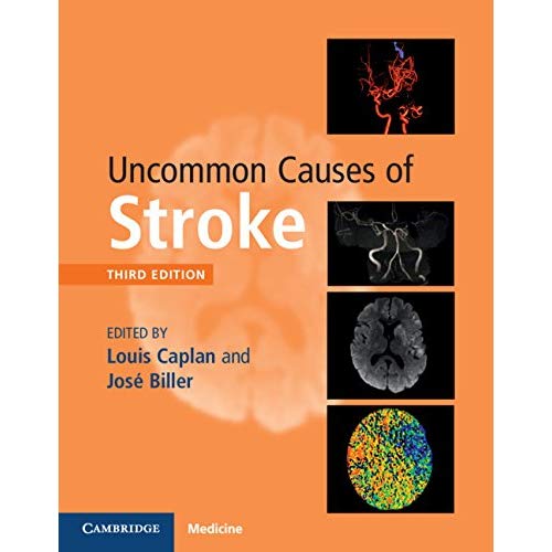 Uncommon Causes of Stroke