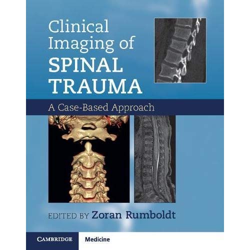Clinical Imaging of Spinal Trauma: A Case-Based Approach