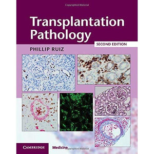 Transplantation Pathology Hardback with Online Resource