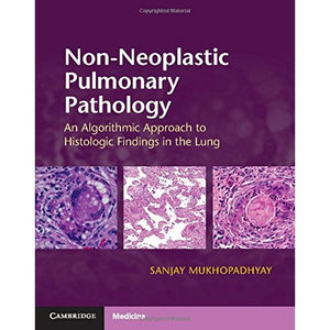 Non-Neoplastic Pulmonary Pathology with Online Resource: An Algorithmic Approach to Histologic Findings in the Lung