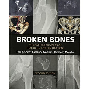 Broken Bones: The Radiologic Atlas of Fractures and Dislocations