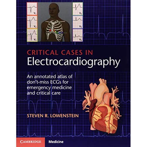 Critical Cases in Electrocardiography: An Annotated Atlas of Don't-Miss ECGs for Emergency Medicine and Critical Care