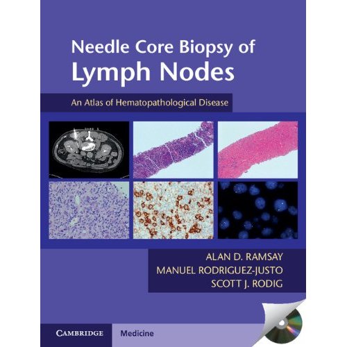Needle Core Biopsy of Lymph Nodes with DVD-ROM: An Atlas of Hematopathological Disease