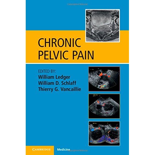 Chronic Pelvic Pain
