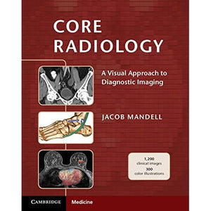 Core Radiology: A Visual Approach to Diagnostic Imaging