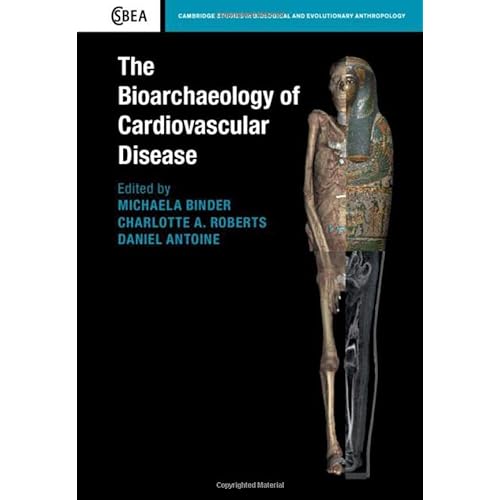 The Bioarchaeology of Cardiovascular Disease: 91 (Cambridge Studies in Biological and Evolutionary Anthropology, Series Number 91)