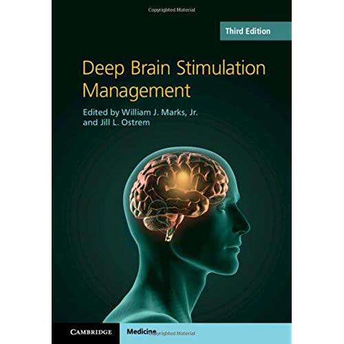 Deep Brain Stimulation Management