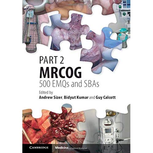 Part 2 MRCOG: 500 EMQs and SBAs