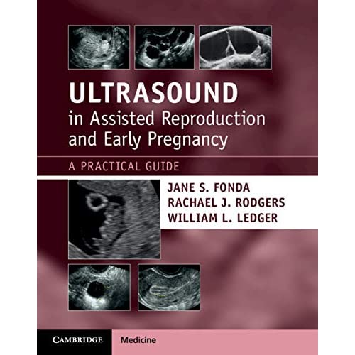 Ultrasound in Assisted Reproduction and Early Pregnancy: A Practical Guide