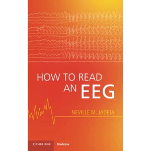 How to Read an EEG