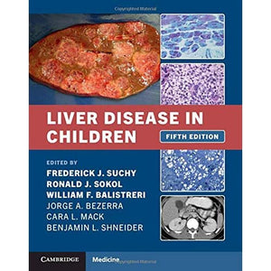 Liver Disease in Children