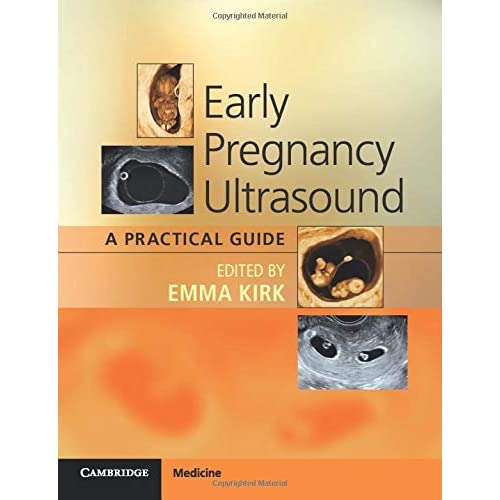 Early Pregnancy Ultrasound: A Practical Guide