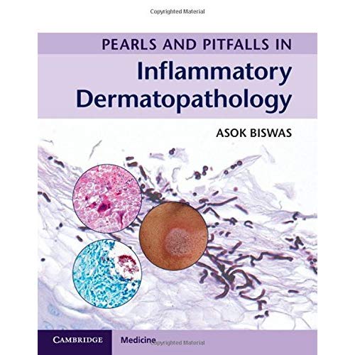 Pearls and Pitfalls in Inflammatory Dermatopathology