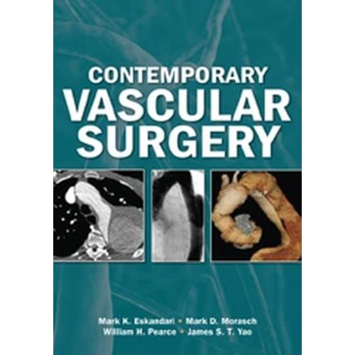 Contemporary Vascular Surgery