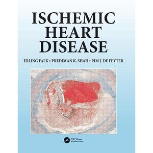 Ischemic Heart Disease