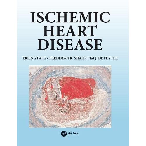 Ischemic Heart Disease