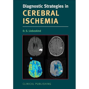 Cerebral Ischemia (Diagnostic Strategies)